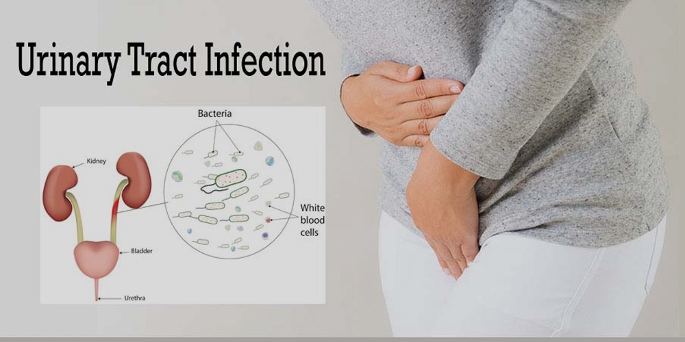 A Comprehensive Guide on Preventing Urinary Tract Infections (UTIs) During Pregnancy