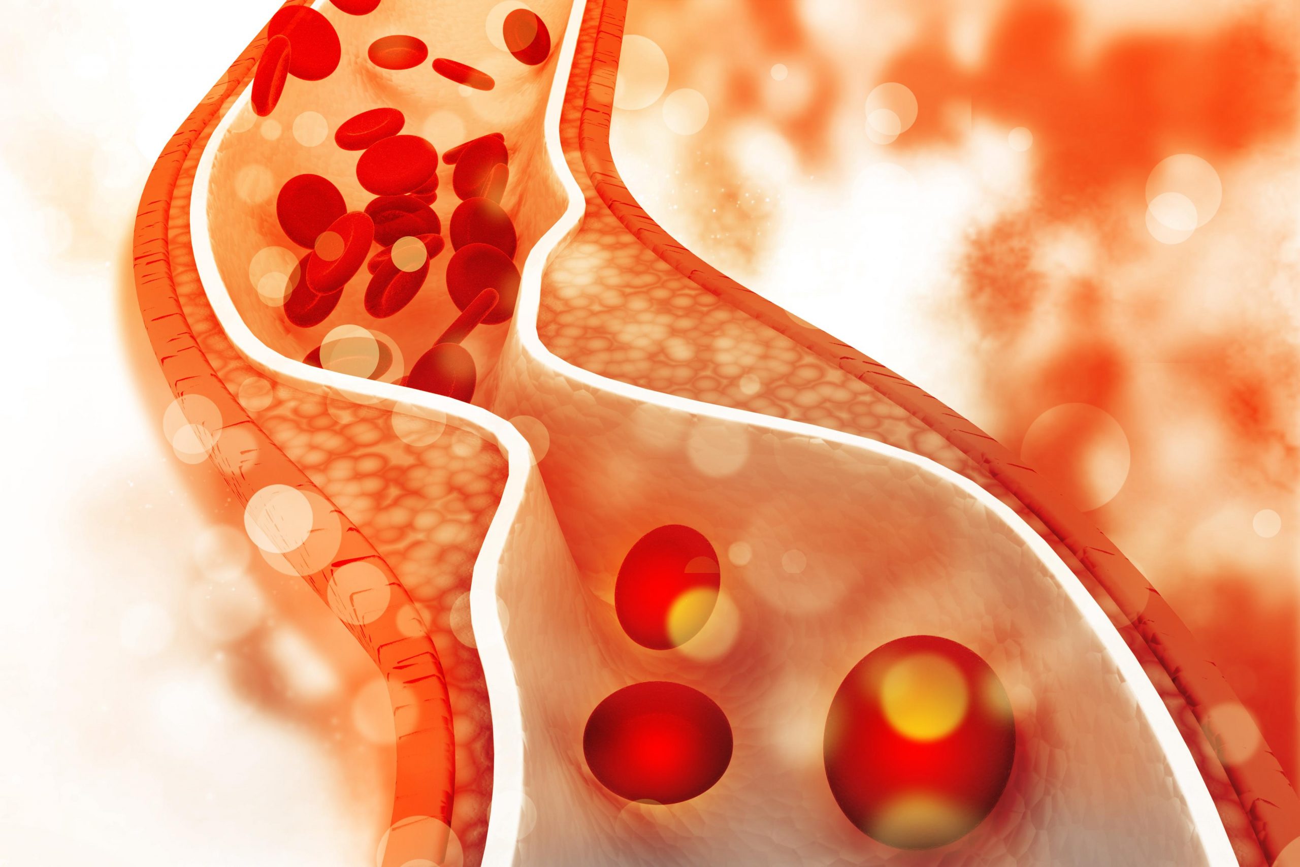 Cholesterol Warning Sign That Can Be Found in Your Toenail