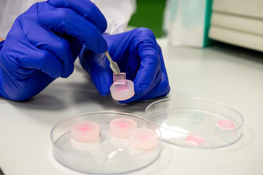 New Microneedle Technology Developed to Treat Diabetic Wounds