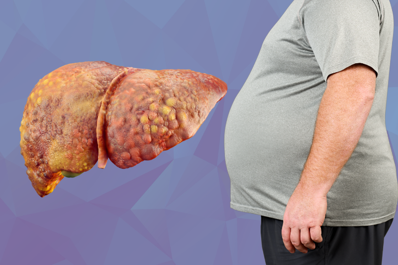 The Hidden Connection between Diabetes and Fatty Liver Disease