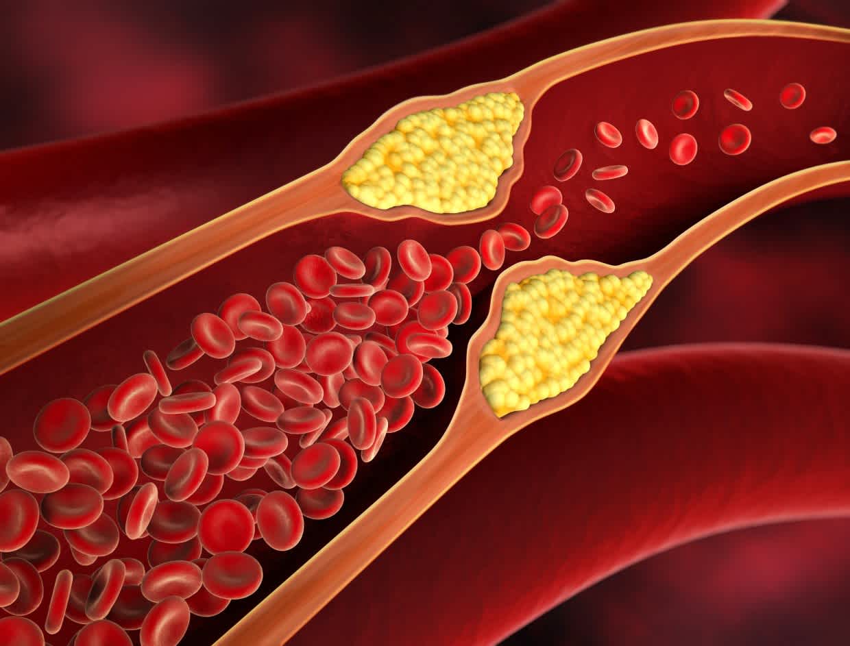 Cholesterol Isn’t Only an Old-People Problem: When Should You Check Yours?